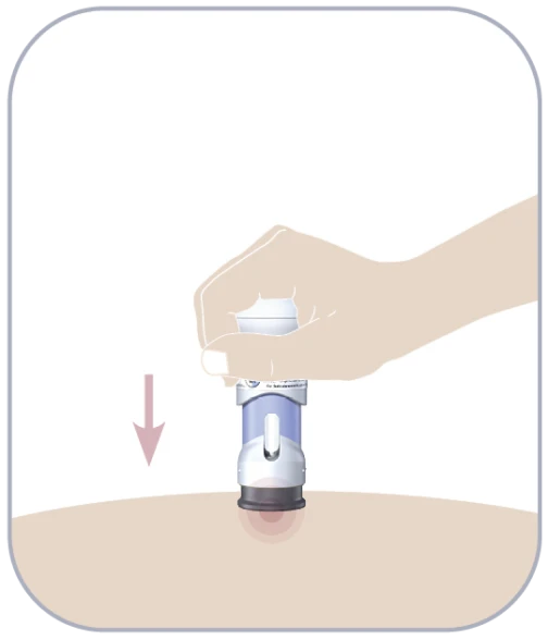 Administration | Acthar® Gel (repository corticotropin injection)