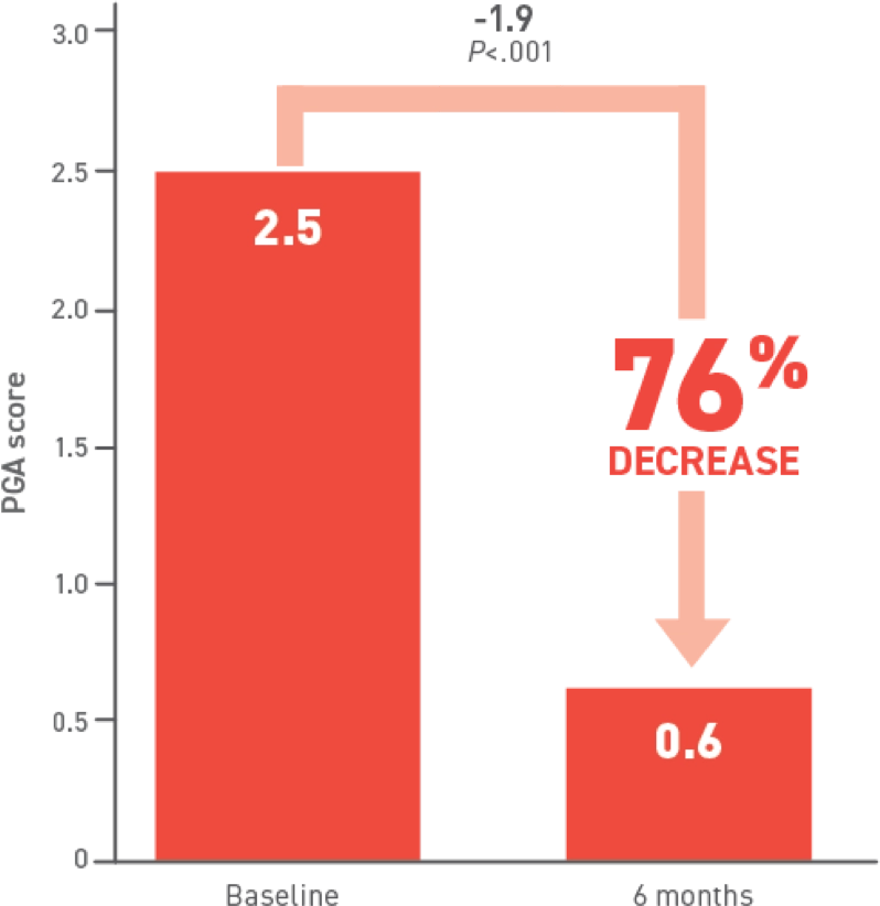 Acthar Gel DM decrease in median PGA scores